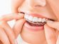 How Does Invisalign Work? Here’s What You Need To Know