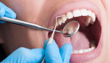3 Reasons To Consider Changing Dentists