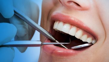 Dental Treatments That You Might Need