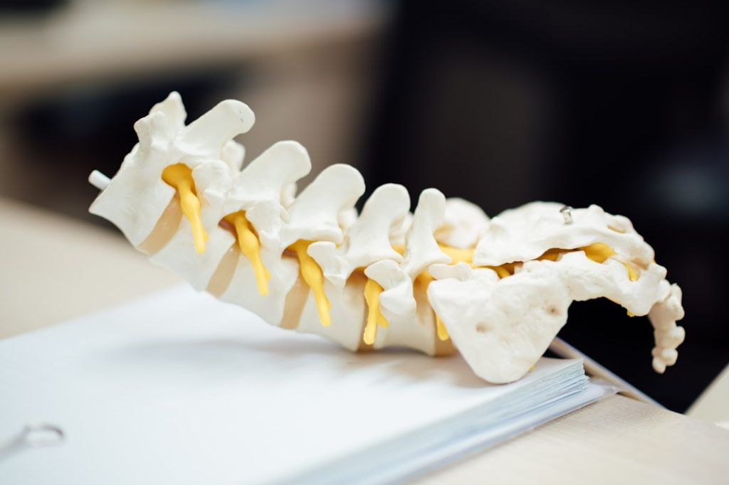 A detailed model of a human spine demonstrating anatomical features including yellow nerve roots.